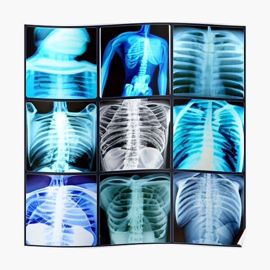 Discover Radiology / Radiography // X-ray art Premium Matte Vertical Poster