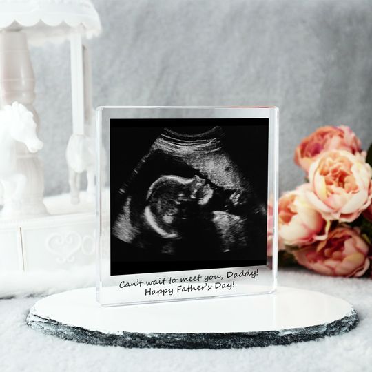 Personalized Baby Ultrasound Photo Acrylic Plaque, Baby Announcement, Fathers Day Sonogram, First Fathers Day, New Dad Gift,Ultrasound Gift